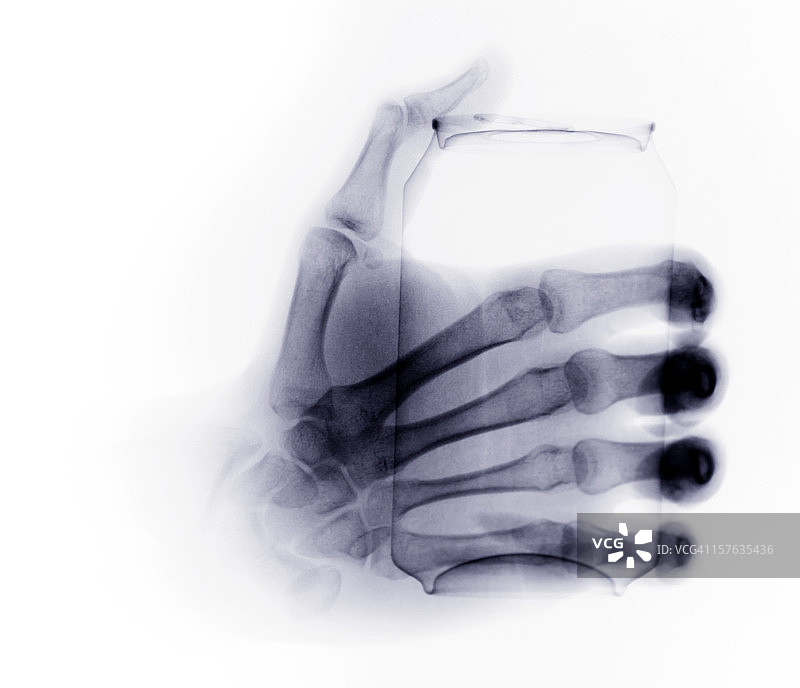 手持果汁罐头X光片图片素材