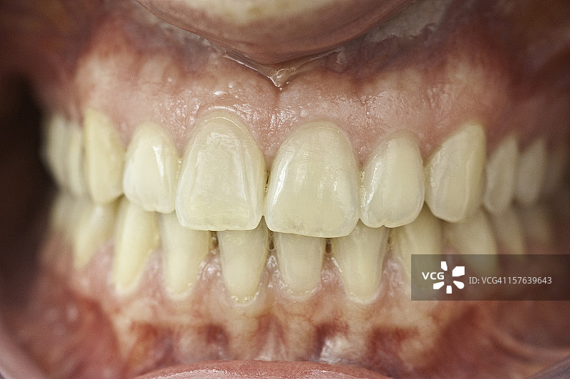健康人类牙齿模型套装图片素材