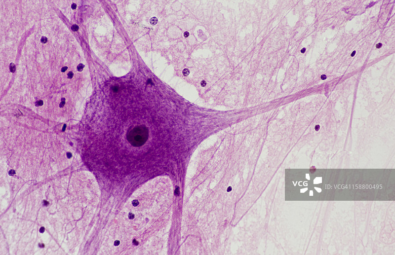 多极运动神经元、细胞体、树突、轴突图片素材