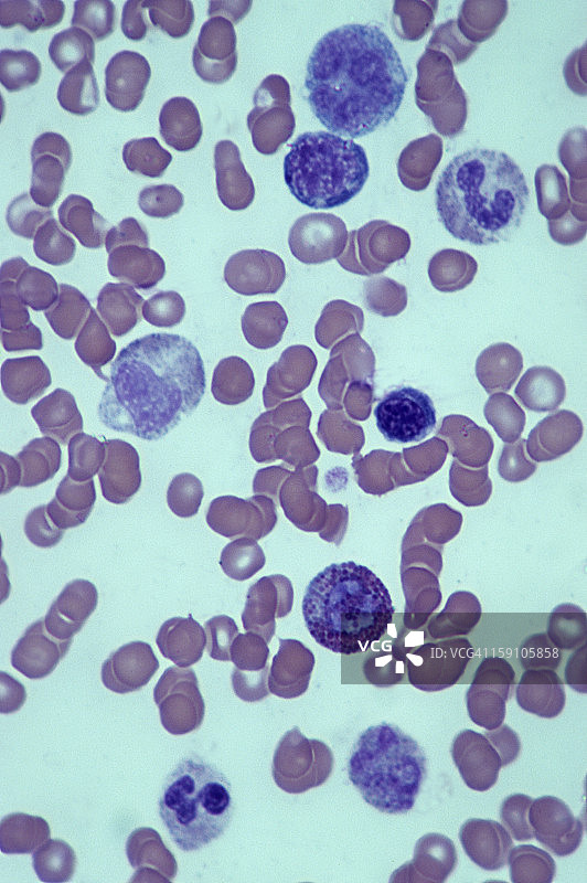 骨髓早期发育阶段（250倍放大）图片素材