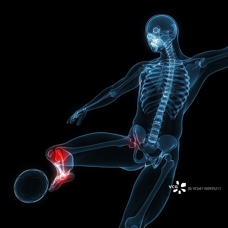 足球受伤艺术作品图片素材