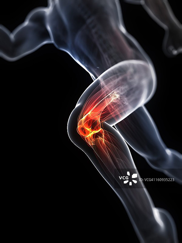 跑步损伤概念艺术作品图片素材