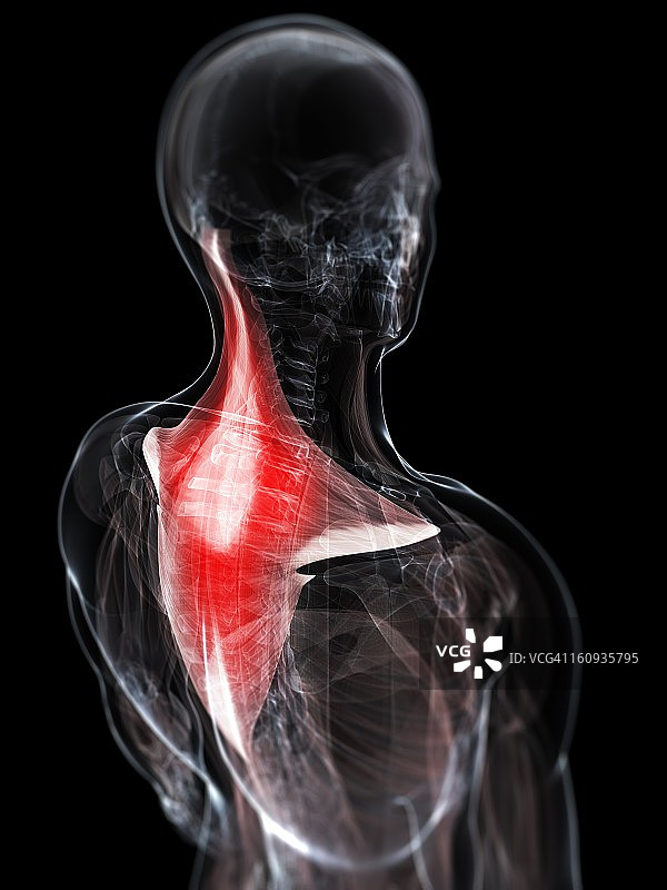 颈部疼痛概念艺术作品图片素材