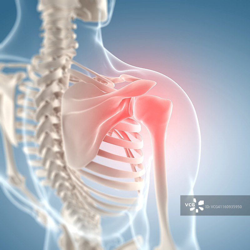 肩部疼痛概念艺术作品图片素材