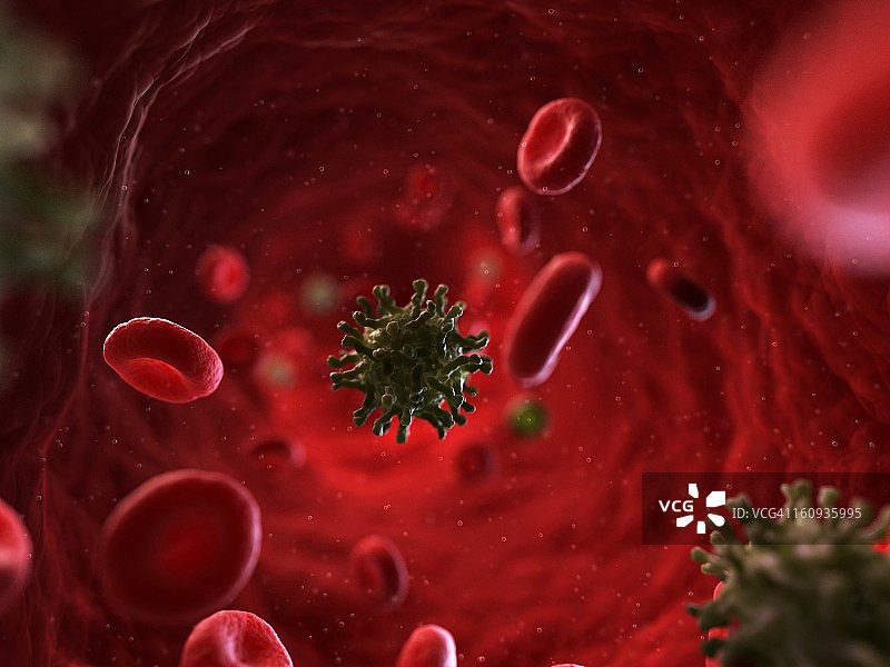 脊髓灰质炎感染艺术作品图片素材