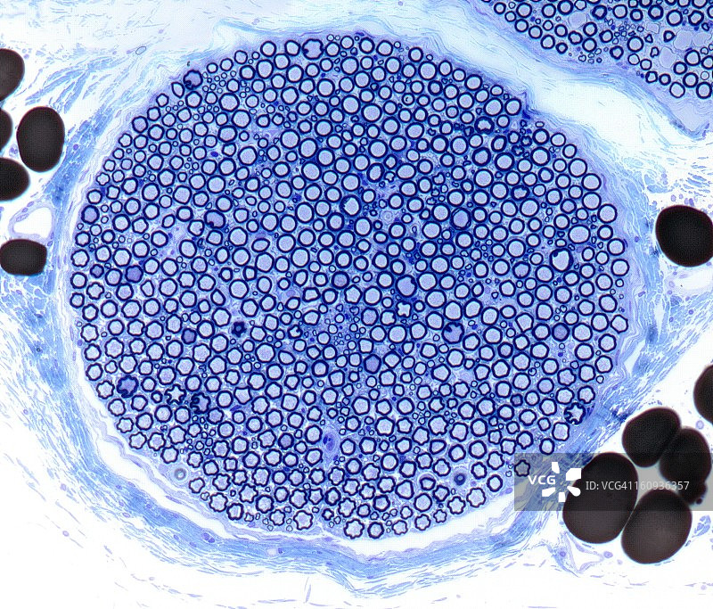 神经束光显微照片图片素材