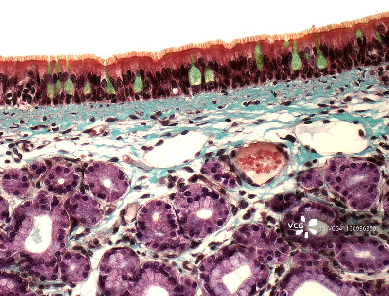 气管显微照片图片素材