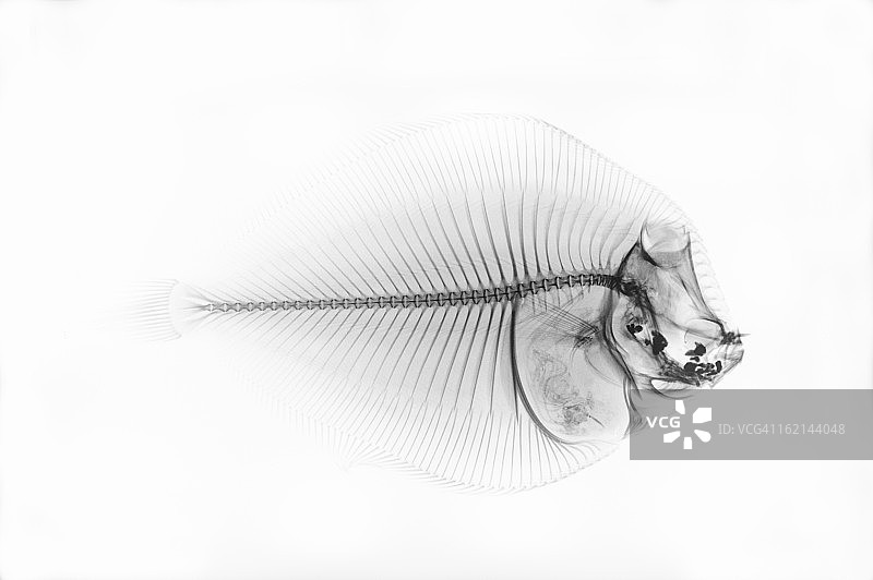 白色背景下的倒置比目鱼X光片图片素材