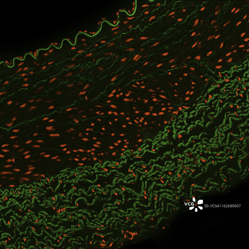 动脉免疫荧光图片素材