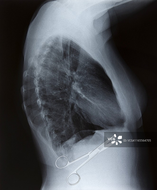 外科手术失误概念图图片素材