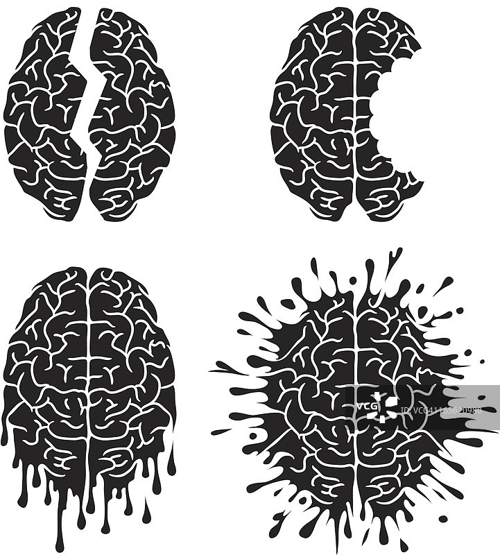 脑损伤图片素材