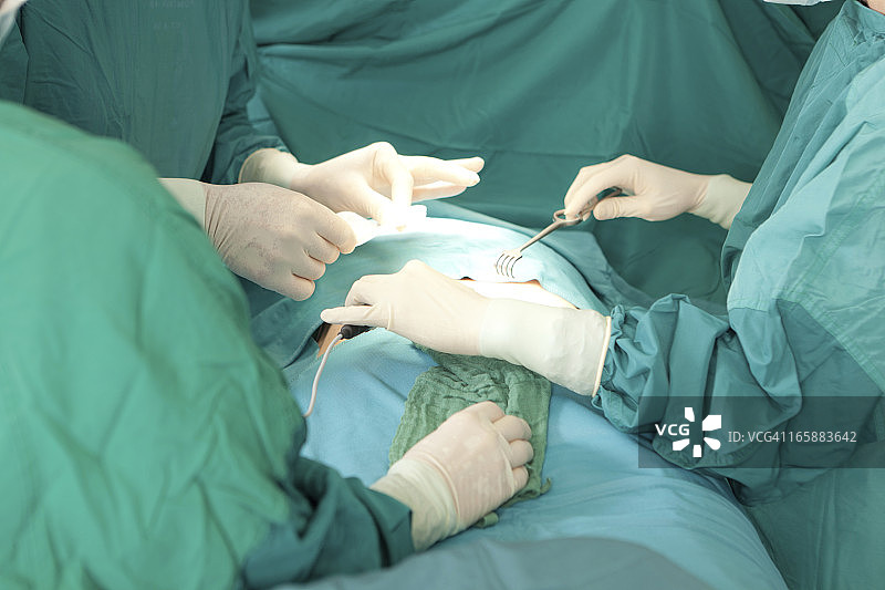 戴着手套的外科医生之手特写图片素材