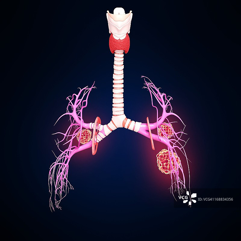 肺癌艺术作品图片素材