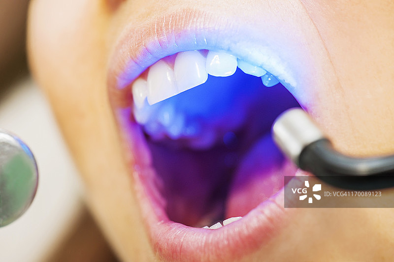 紫外线牙科治疗图片素材