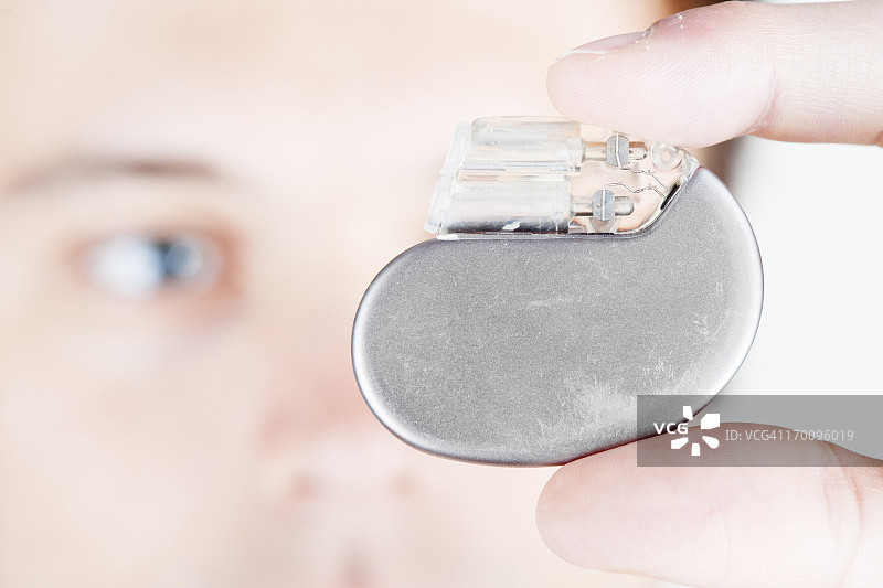 心脏起搏器图片素材