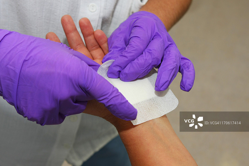 在整形外科做完腕管综合征手术后的病人图片素材