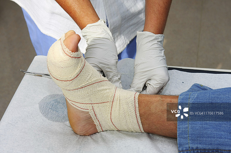 护士在工作，为受伤病人的踝关节更换绷带图片素材