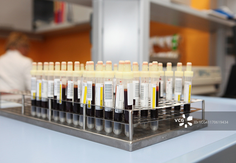 血库中的血液样本试管图片素材