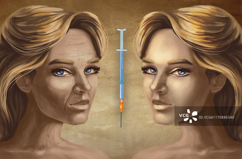 肉毒杆菌注射后的女性面部效果图图片素材