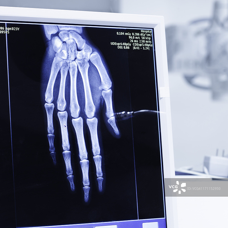 医院X光或扫描射线照片分析图片素材