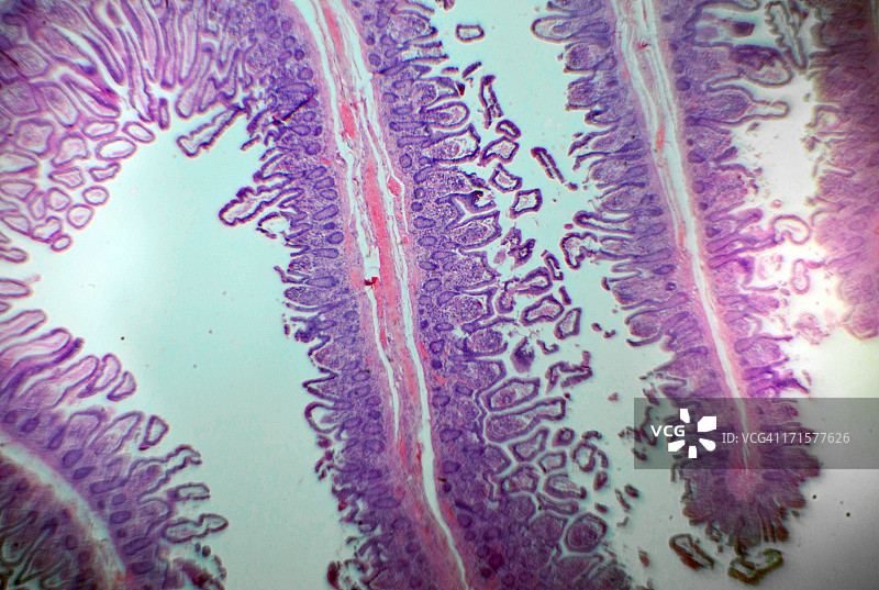 显微镜下的人体肠道切片图片素材