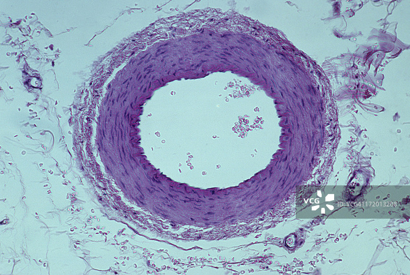 显示血管层或膜的正常动脉，50倍图片素材