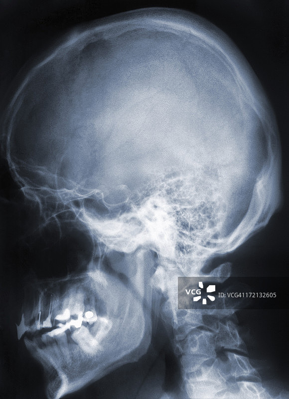 头骨、大脑和颈椎的X光图像，蓝色调图片素材