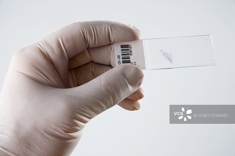 病理学切片图片素材