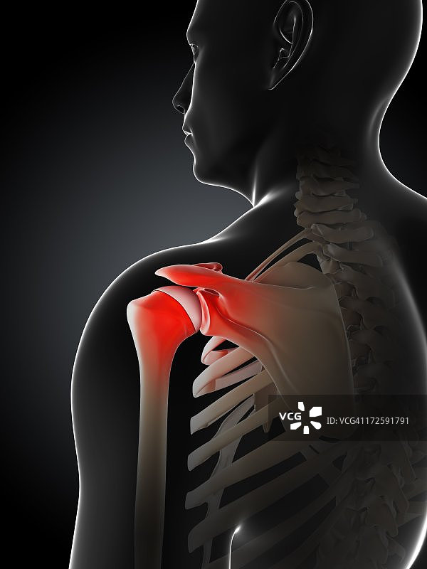 肩部疼痛概念艺术作品图片素材