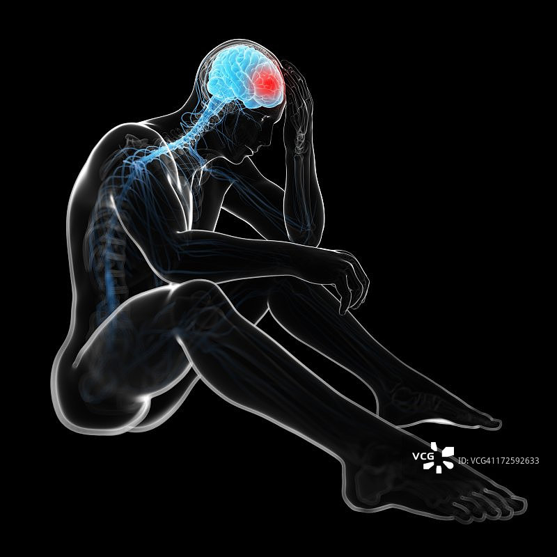 头痛，艺术作品图片素材