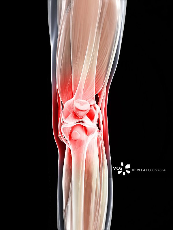 膝盖疼痛概念图图片素材