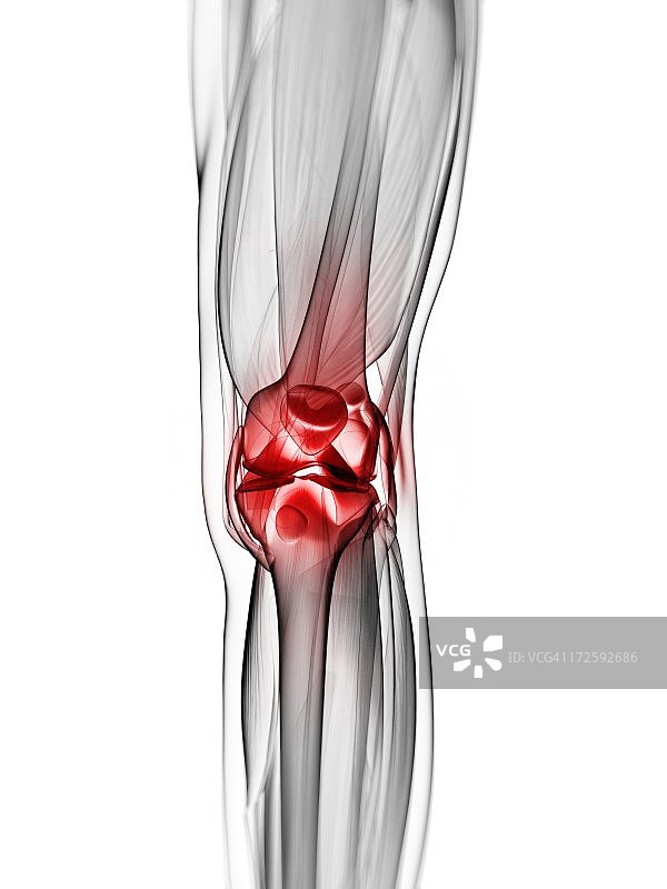 膝盖疼痛概念图图片素材