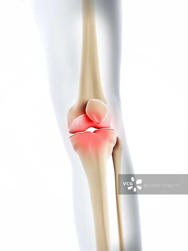 膝盖疼痛概念图图片素材
