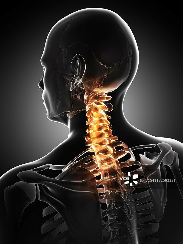 颈部疼痛概念艺术作品图片素材