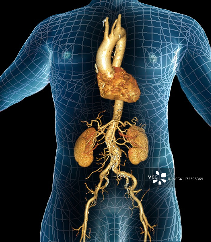 主动脉3D CT扫描图片素材