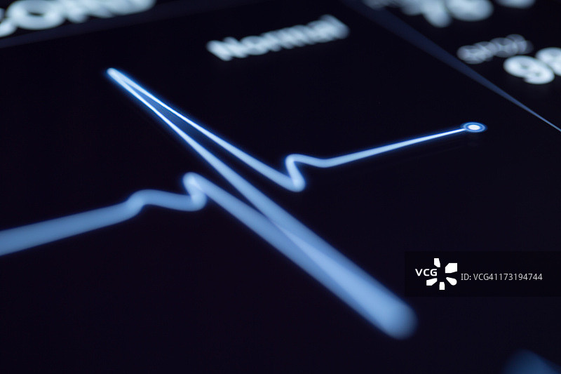 机器上的心跳特写图片素材