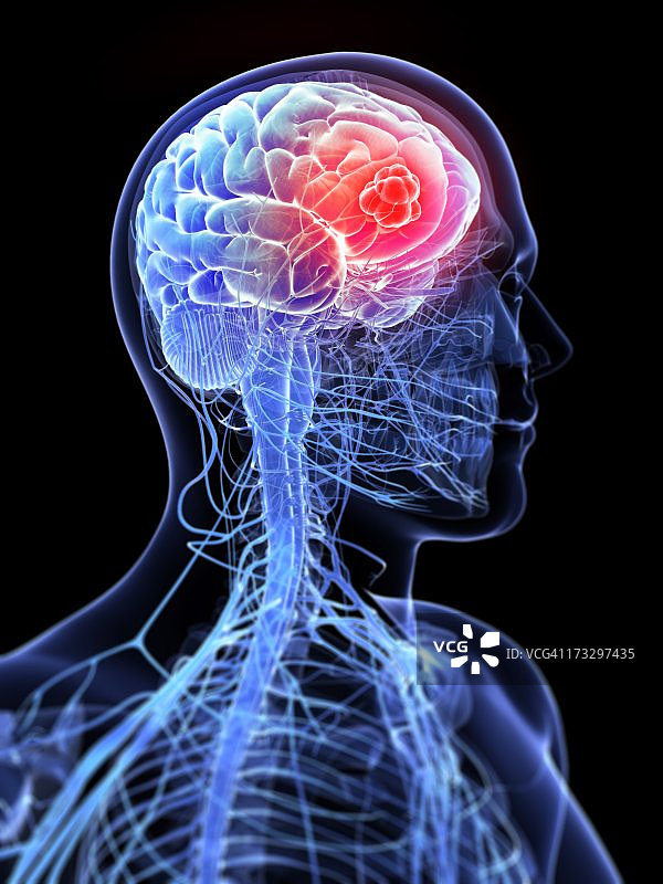脑癌艺术作品图片素材