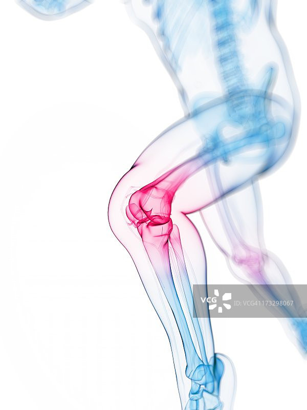 膝盖疼痛概念图图片素材