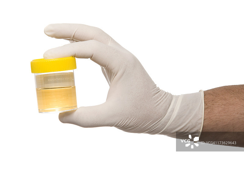 手戴橡胶手套，拿着尿液样本图片素材