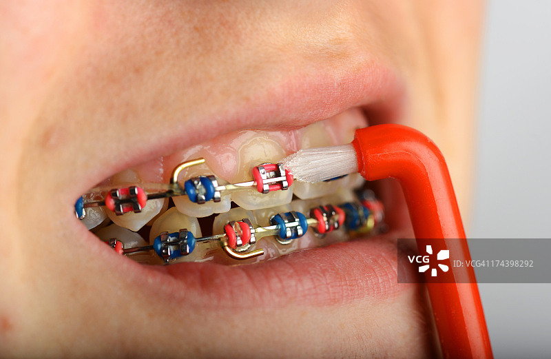 孩子清洁牙齿和牙套图片素材