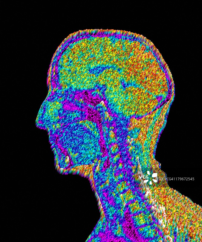 男人头部核磁共振图片素材