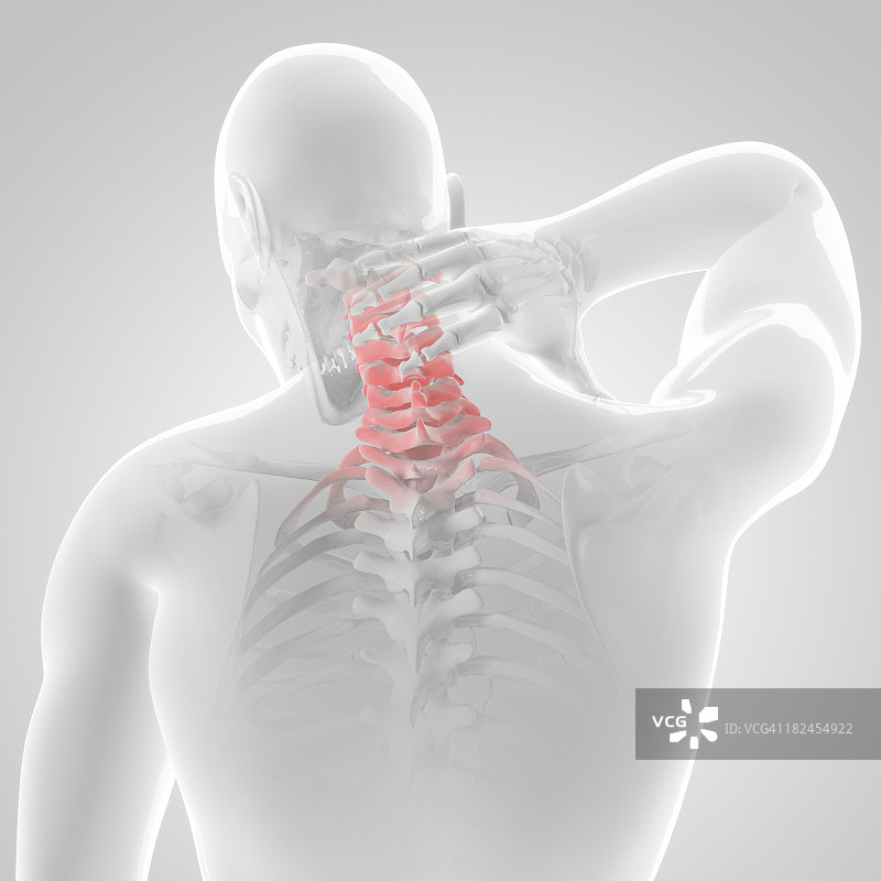 颈部疼痛插图图片素材