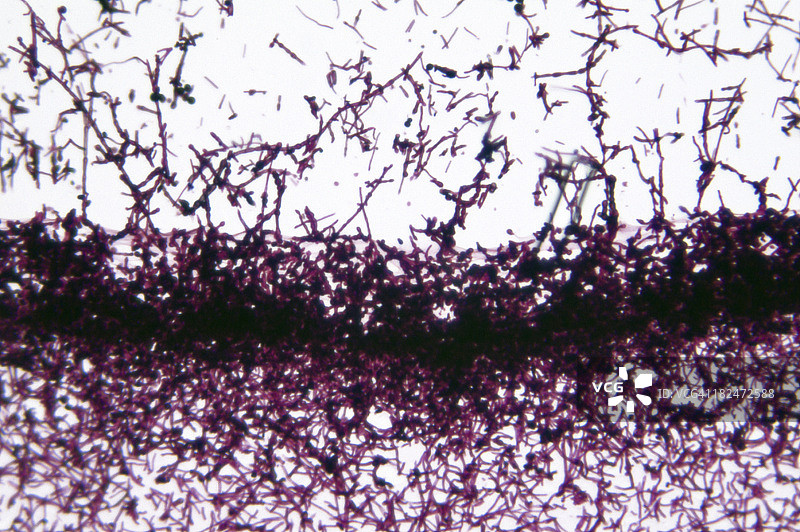 白色念珠菌酵母图片素材