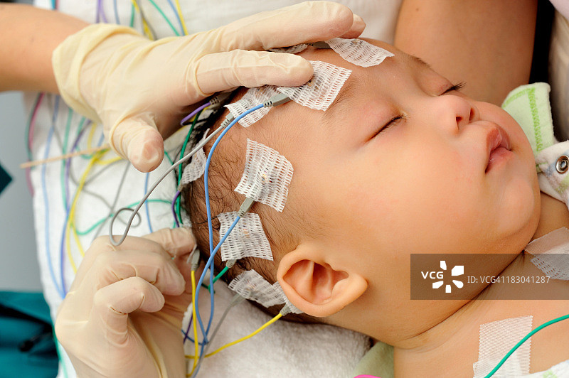 为婴儿进行脑电图检查时，手部贴着电极图片素材