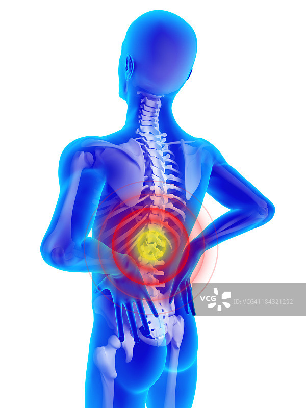 背痛图片素材