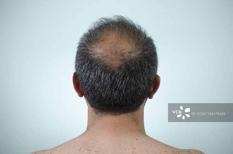 秃顶男人的头部背面图片素材