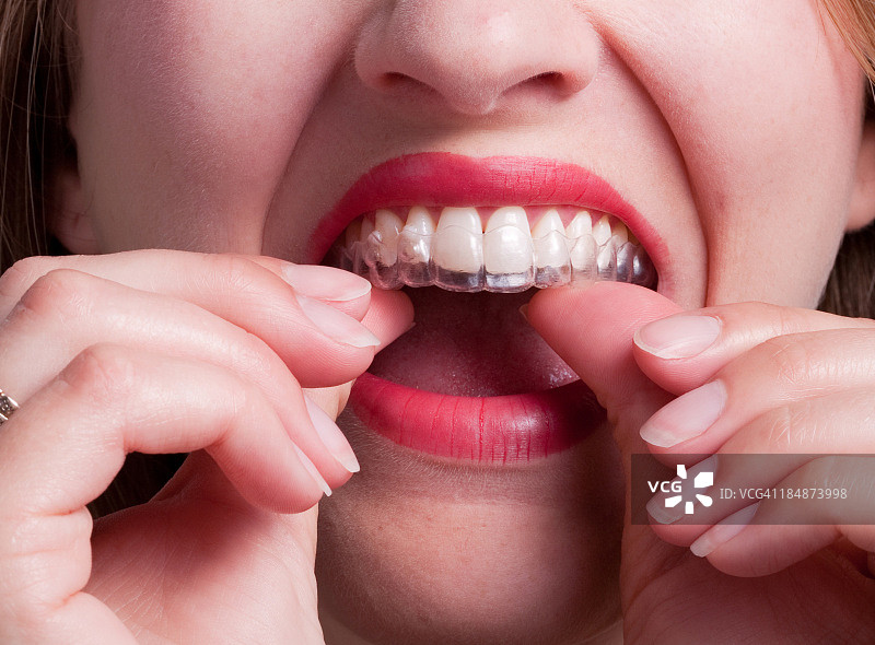 女子戴上塑料牙齿保持器图片素材