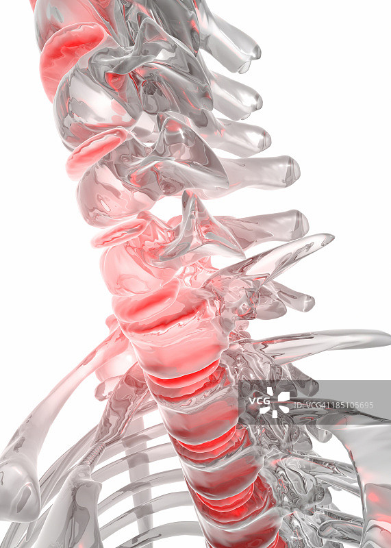 背痛的人体骨骼图片素材