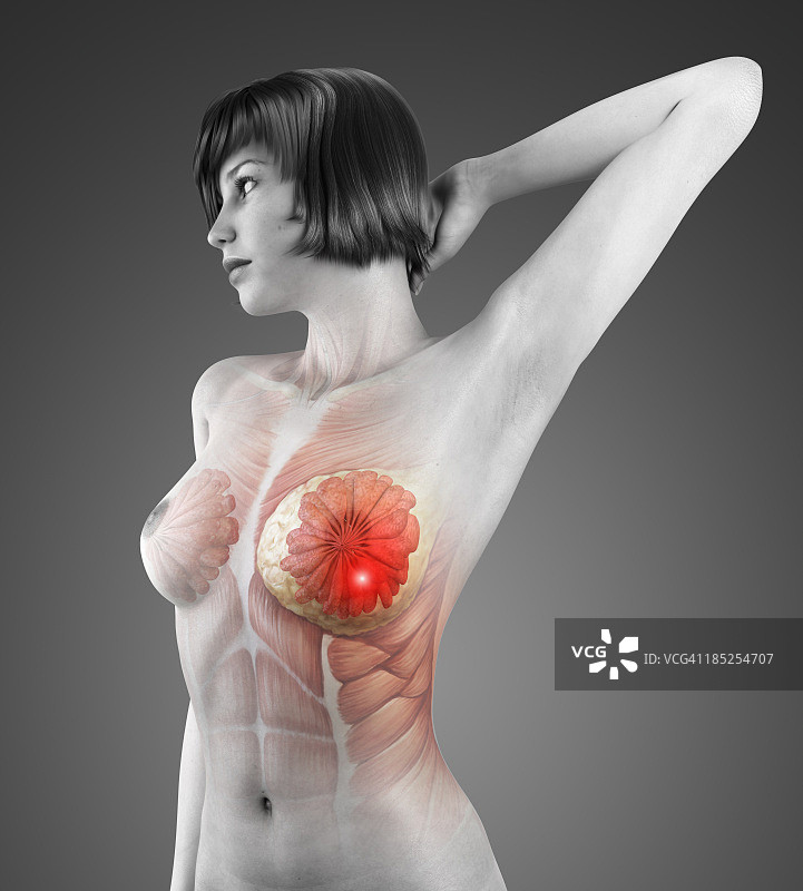 乳腺癌图片素材