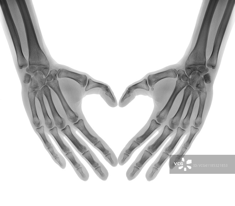 负片X光人手掌心形图片素材